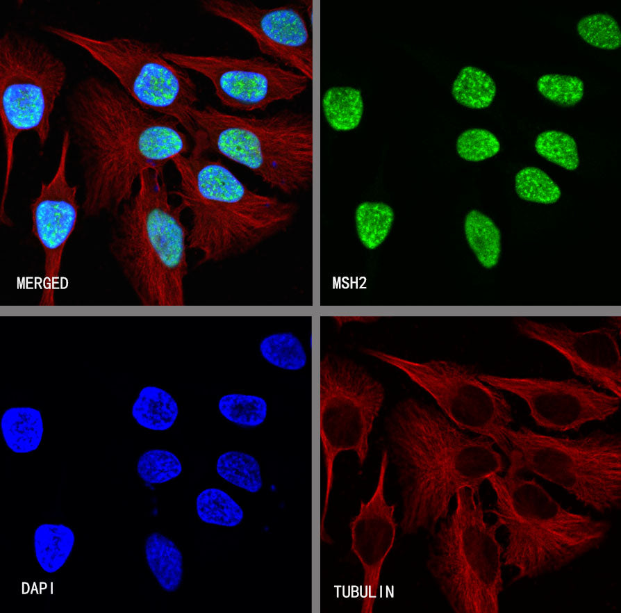 MSH2 Recombinant Rabbit mAb (SDT-037-20)