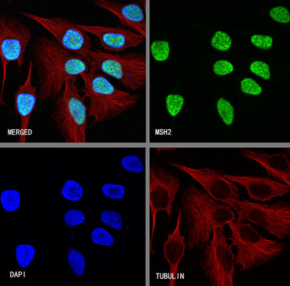 MSH2 Recombinant Rabbit mAb (SDT-037-20)