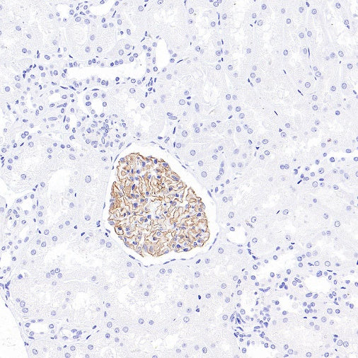 NPHS2 Recombinant Rabbit mAb (S-1824-36)