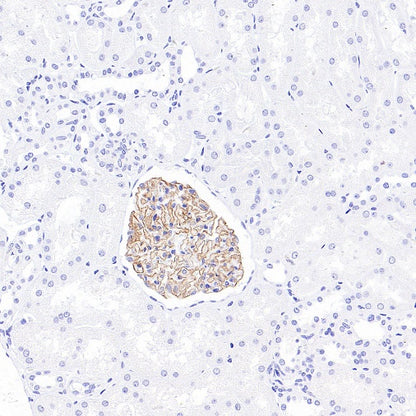 NPHS2 Recombinant Rabbit mAb (S-1824-36)