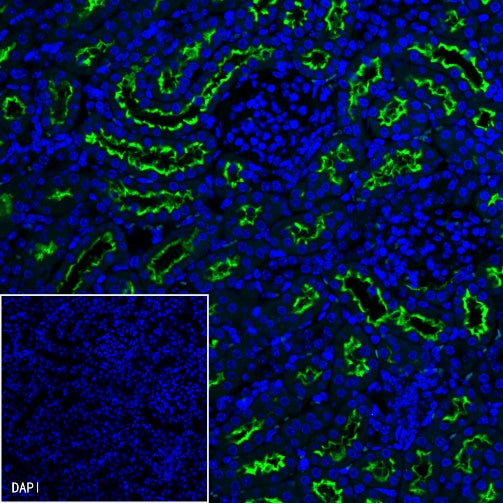 ACE2 Recombinant Rabbit mAb (S-1348-7)