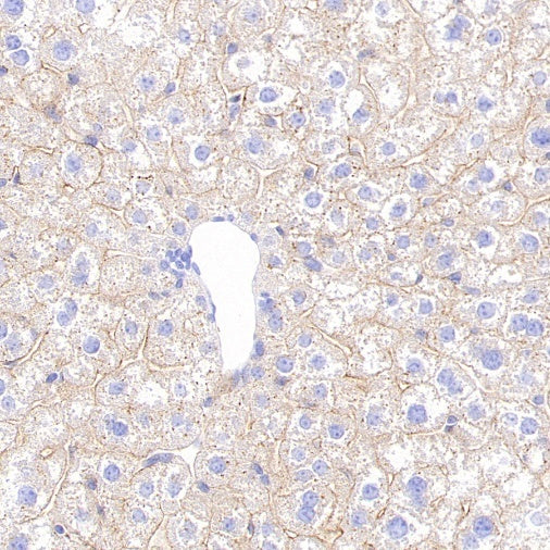 STEAP3 Recombinant Rabbit mAb (S-4466-26)