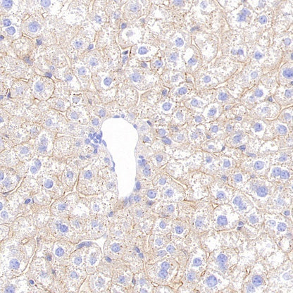 STEAP3 Recombinant Rabbit mAb (S-4466-26)