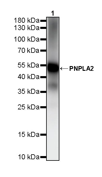 PNPLA2 Recombinant Rabbit mAb (S-5409)