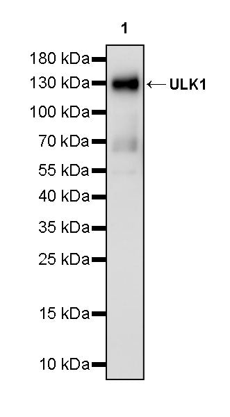ULK1 Recombinant Rabbit mAb (S-5302)