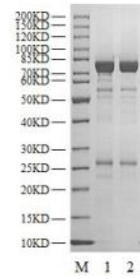 MRCKα GST Tag Protein, Human