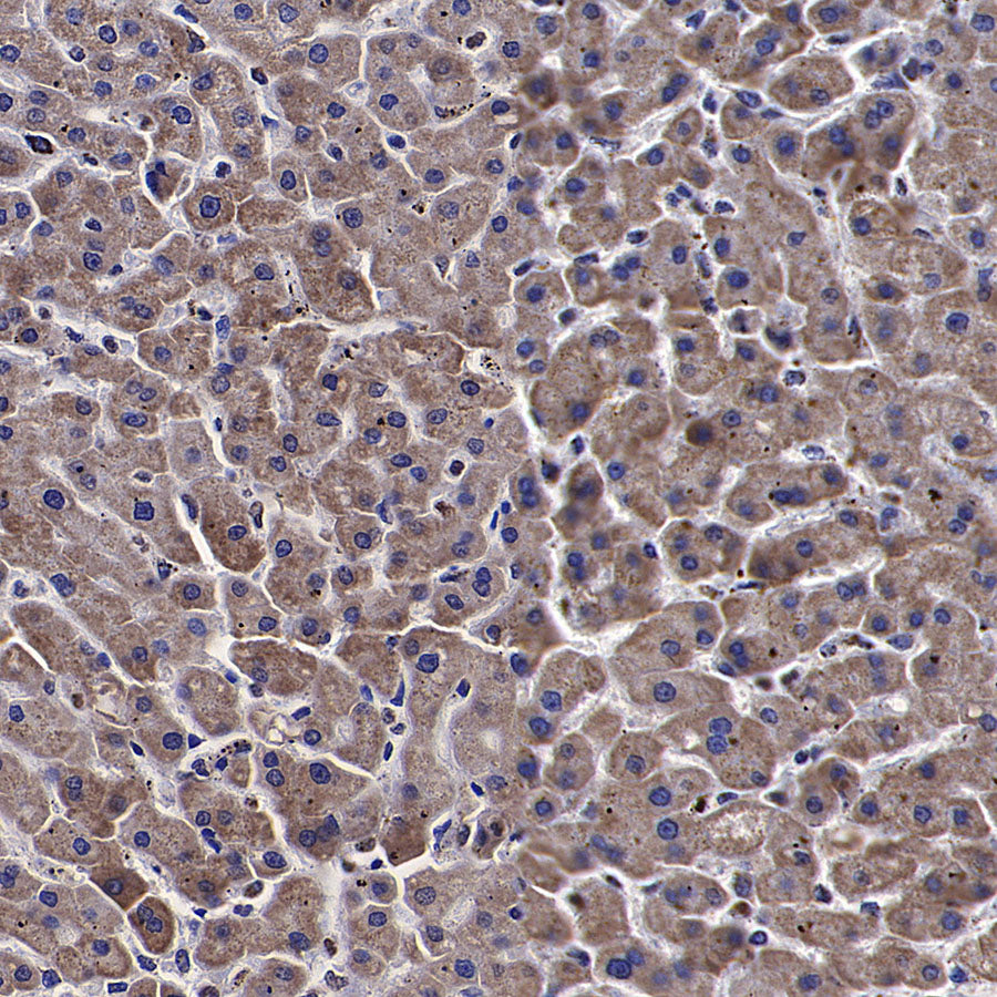PDHE1 Alpha Mouse mAb
