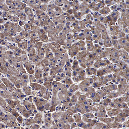 PDHE1 Alpha Mouse mAb