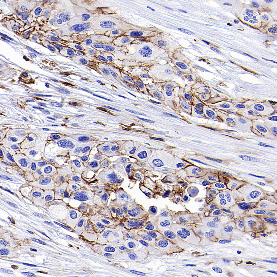 CD44 Rabbit Polyclonal Antibody