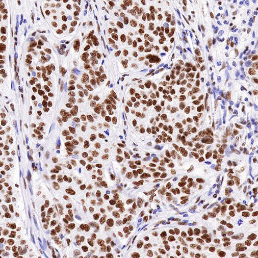 nmt55/p54nrb Recombinant Rabbit mAb (S-1745-48)