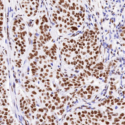 nmt55/p54nrb Recombinant Rabbit mAb (S-1745-48)