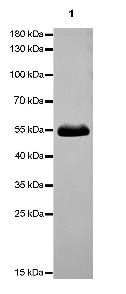 β-tubulin Recombinant Rabbit mAb (SDT-R014)