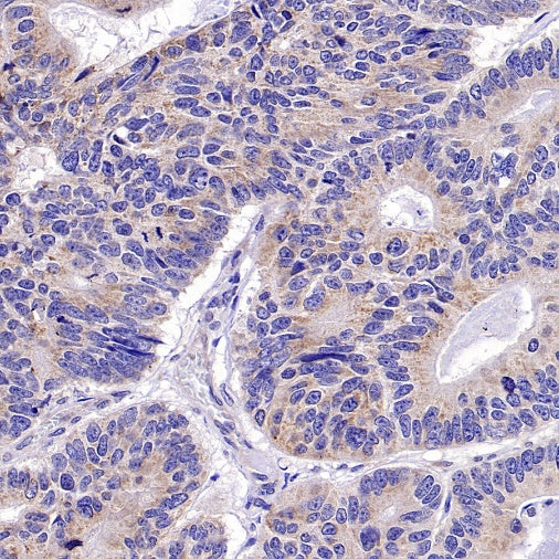 RIPK1 Rabbit Polyclonal Antibody