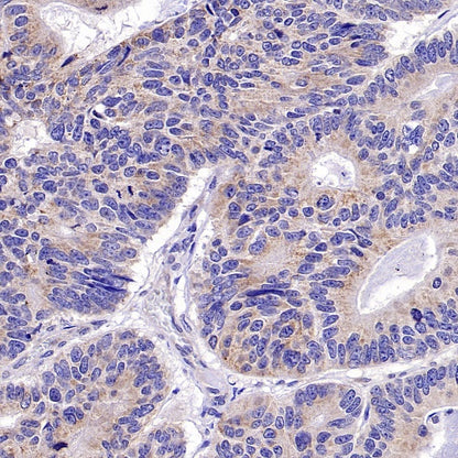 RIPK1 Rabbit Polyclonal Antibody