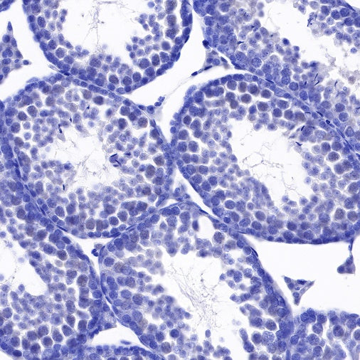 RNA polymerase II CTD repeat YSPTSPS (phosphor S2) Recombinant Rat mAb (S-R199)