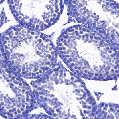 RNA polymerase II CTD repeat YSPTSPS (phosphor S2) Recombinant Rat mAb (S-R199)