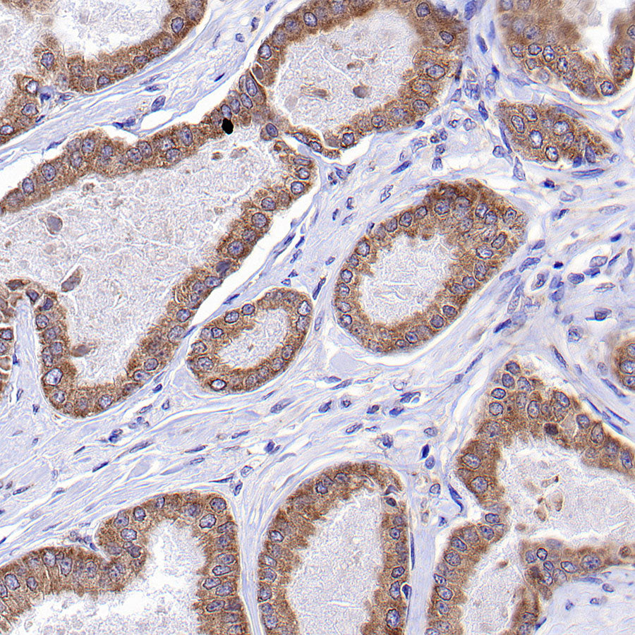 CCDC47 Recombinant Rabbit mAb (S-4158-17)