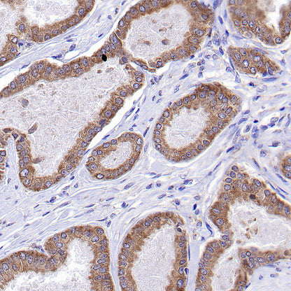CCDC47 Recombinant Rabbit mAb (S-4158-17)