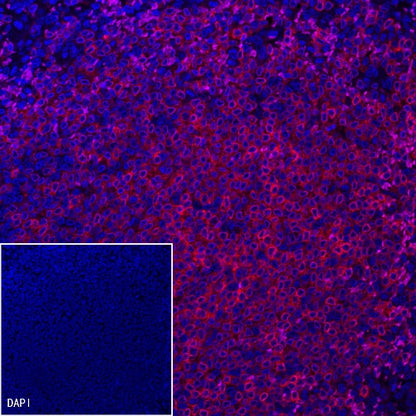 CD79a/MB-1 Recombinant Rabbit mAb (Alexa Fluor® 555 Conjugate) (S-030-18)