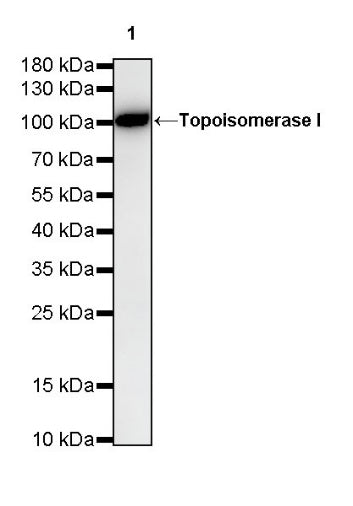 S-RMab®Topoisomerase I Recombinant Rabbit mAb (S-R209)