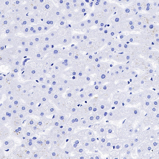 Pepsinogen I Recombinant Rabbit mAb (S-723-104)