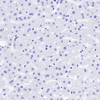 Pepsinogen I Recombinant Rabbit mAb (S-723-104)