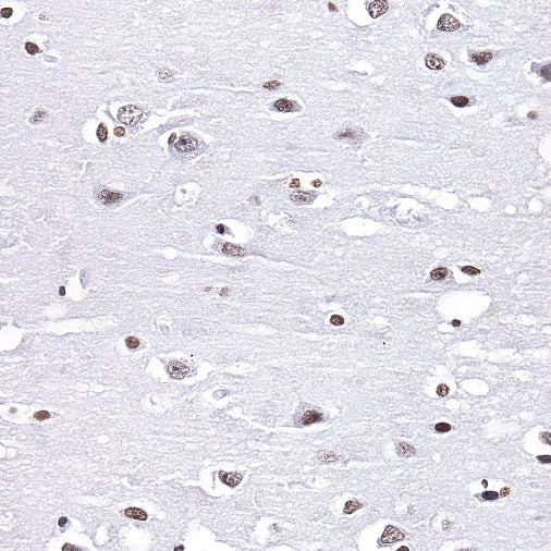 Histone H3 (mono methyl K4) Rabbit polyclonal antibody