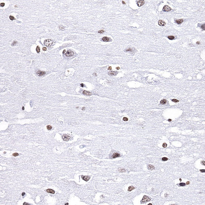 Histone H3 (mono methyl K4) Rabbit polyclonal antibody
