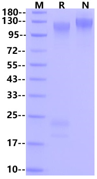 Glycoprotein/GP His Tag Protein, Ebola Virus-Q7T9D9