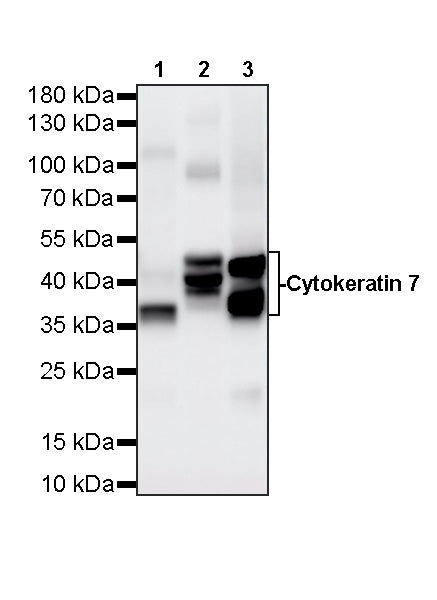 Cytokeratin 7 Recombinant Rabbit mAb (S-5954)
