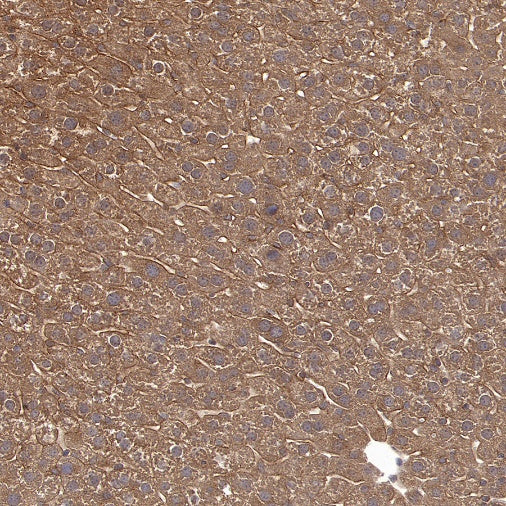 CAD/BM1 Recombinant Rabbit mAb (S-1650-72)