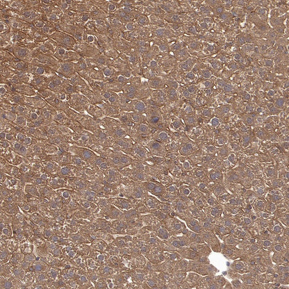 CAD/BM1 Recombinant Rabbit mAb (S-1650-72)