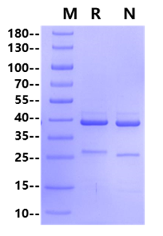 NEK7 His Tag Protein, Human