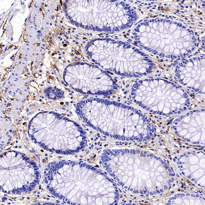 PTK7 Recombinant Rabbit mAb (SDT-2432-156)
