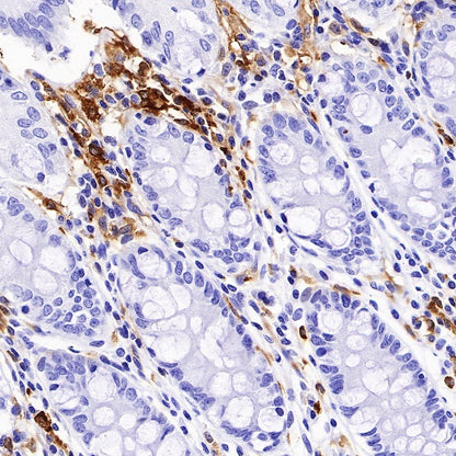 HLA-DPB1 Recombinant Rabbit mAb (S-R263)
