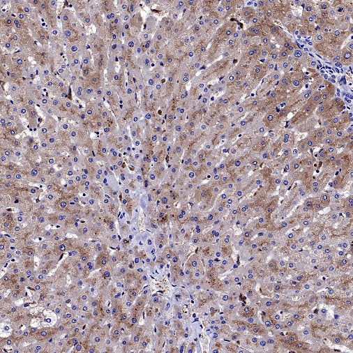AACT Recombinant Rabbit mAb (S-897-109)