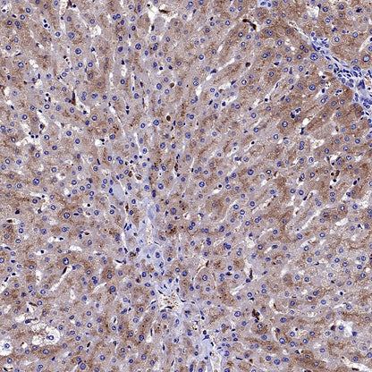 AACT Recombinant Rabbit mAb (S-897-109)