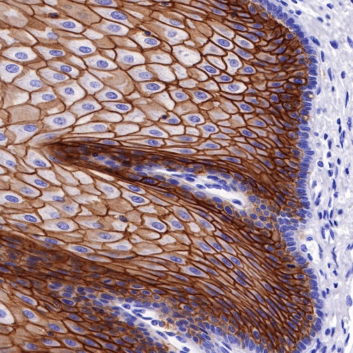 TACSTD2/TROP2 Recombinant Rabbit mAb (S-R237)