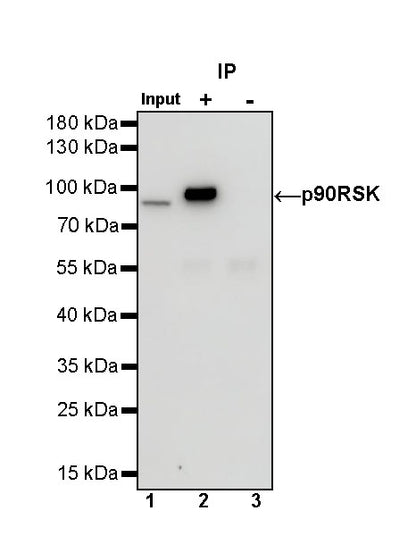 p90RSK Recombinant Rabbit mAb (S-1024-26)