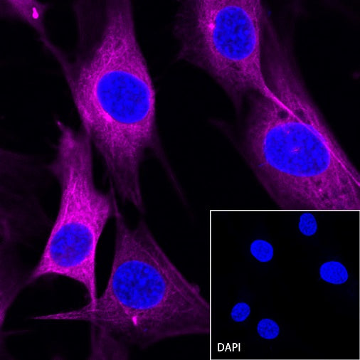 β-tubulin Recombinant Rabbit mAb (Alexa Fluor®647 Conjugate) (S-312-113)
