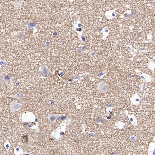 SMAD2 Recombinant Rabbit mAb (S-1521-177)