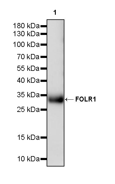 FOLR1 Recombinant Rabbit mAb (SDT-3635-124)