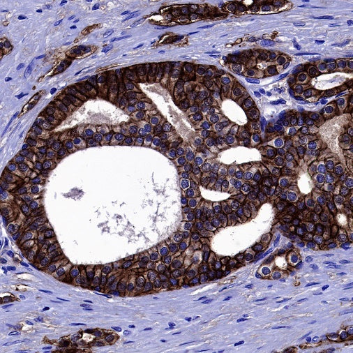 B7-H3 Recombinant Rabbit mAb (SDT-1333-8)