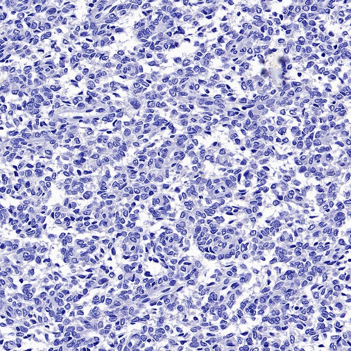 Myogenin Recombinant Rabbit mAb (SDT-3351)