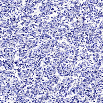 Myogenin Recombinant Rabbit mAb (SDT-3351)