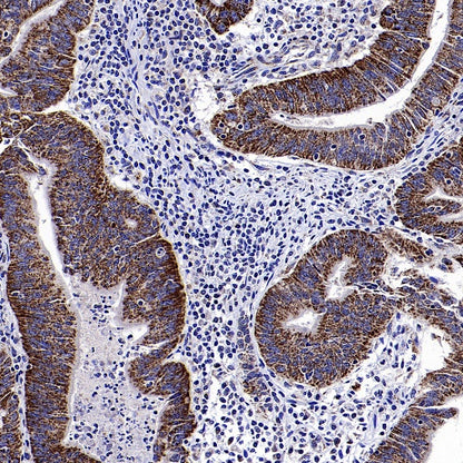 LONP1 Rabbit Polyclonal Antibody