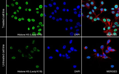 Histone H3 (Lactyl K18) Recombinant Rabbit mAb (S-3217-72)