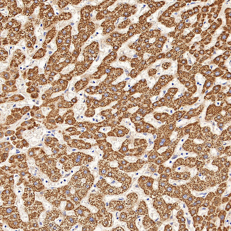 GOT2 Recombinant Rabbit mAb