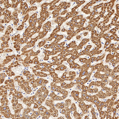 GOT2 Recombinant Rabbit mAb