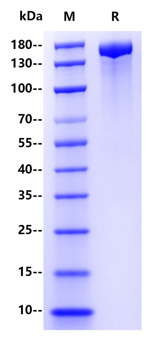 SARS-CoV-2 (BA.4&BA.5/Omicron) S, His Tag Protein